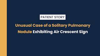 An Unusual Case of a Solitary Pulmonary Nodule Exhibiting Air Crescent Sign | A Case Study