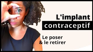 Où mettre le patch pour retirer l'implant ?