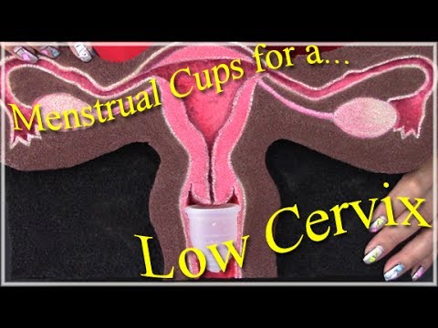 Menstrual Cups for a Low Cervix - YouTube