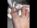 Gentle Toenail Trim | Relaxing Foot Care Routine #nails #footcare