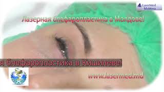 Лазерная блефаропластика Лазерная пластика век, коррекция век лазером  в Кишиневе Молдове!