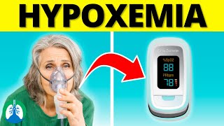 Hypoxemia | Causes, Symptoms, Diagnosis, and Treatment by Respiratory Therapy Zone 3,235 views 1 month ago 9 minutes, 43 seconds