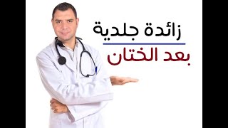 زائدة جلدية بعد الطهارة