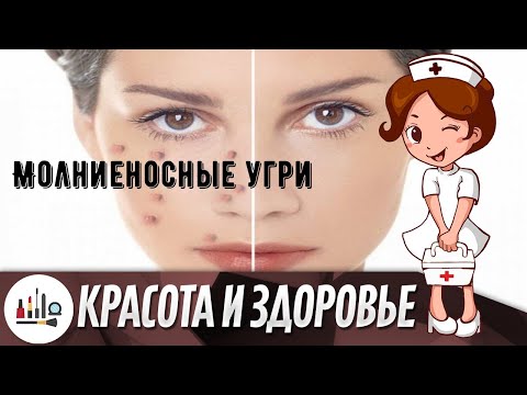 Молниеносные угри