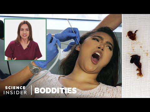 Doctor Explains Earwax Removal | Boddities