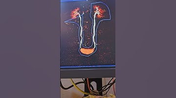 CT Urogram Short Video