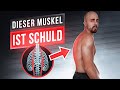 1 Tipp gegen Rundrücken ►►► Übungen die dauerhaft gerade halten(+ Trainingsplan)