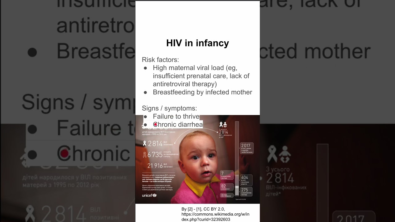 HIV in infancy