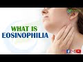 What Is Eosinophilia | Reasons | Foods to Cure Eosinophils | Fitness Forecast Health Tips | 2020