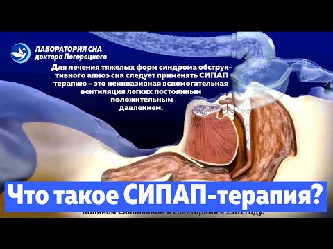 Что такое СИПАП терапия -CPAP-?