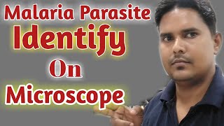 Malaria Parasite Under Microscope Malaria Parasite Procedure P Vivax Malaria In Hindi