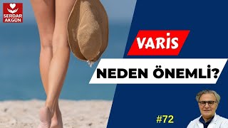 Varis, varis tedavisi nasıl yapılır?