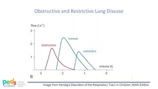Approach to Spirometry
