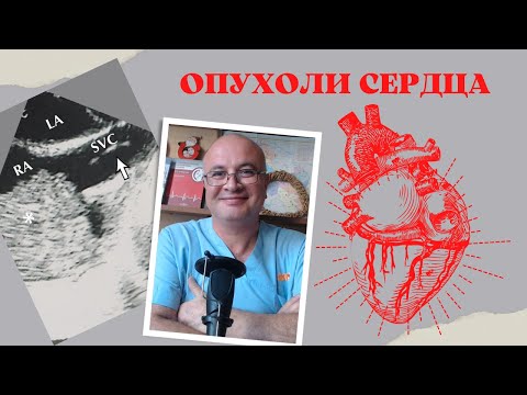 Видео: Когда была обнаружена миксома сердца?