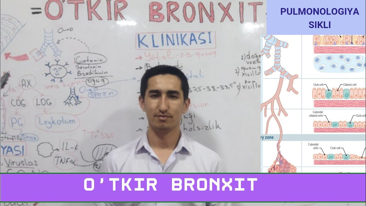 O'tkir Bronxit