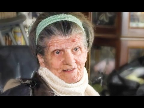 Government Punishes Disabled Woman 