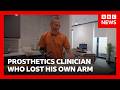 ‘I worked with prosthetic limbs, then I lost my arm’ | BBC News
