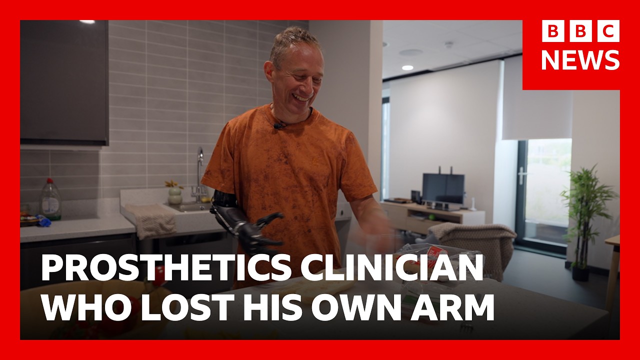 From Prosthetics Clinician to Patient: A Journey Through Amputation and Innovation