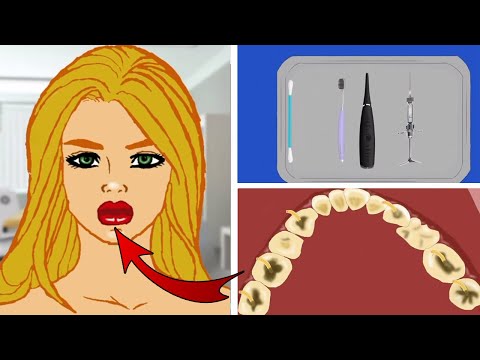 Видео: ASMR  Teeth Treatment Removal of Girl Parasite by | Teeth Deep Cleaning