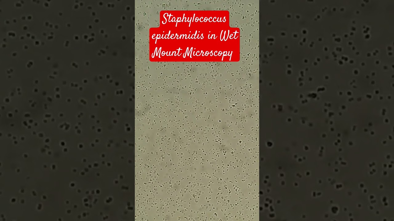 Staphylococcus epidermidis in Wet Mount of Culture Microscopy |Mag.1600X