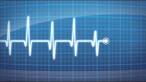 Heart Rate Monitor - After Effects