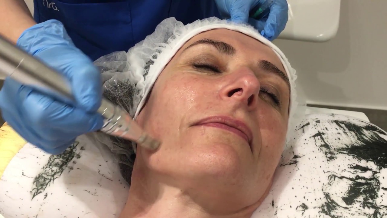 Dr Aurélie Fabié Boulard - Mésothérapie - Toulouse