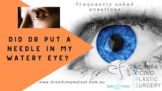 Faq - Did Doctor Put A Needle In My Watery Eye - Dr Anthony Maloof, Sydney Australia