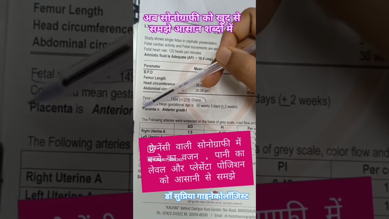सोनोग्राफी में बच्चे का वजन कैसे देखते हैं #pregnancytips #music #ytshorts #pregnancyvlog #trending