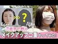 芸能界で噂の「メイクアップ二重」やってみた【美容整形の真崎医院】