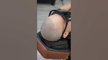 Say BYE to hair loss 🙌🏽#smp #scalpmicropigmentation #artist #hairtransformation #tattoos #shorts