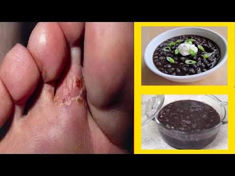 amazing!-ancient-recipe-can-cure-diabetes