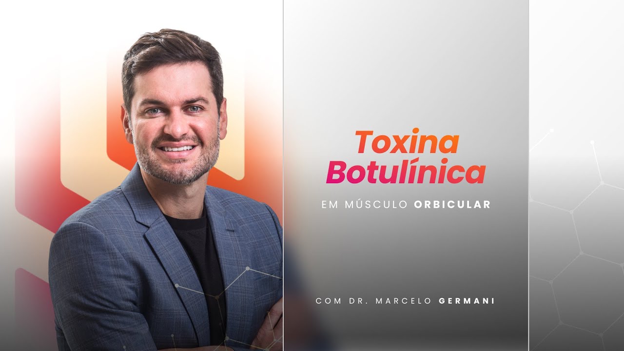 Aplicação de Toxina Botulínica em Músculo Orbicular dos Olhos - YouTube