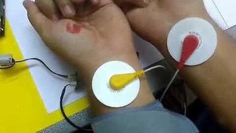 Intel Ultimate Coder Challenge : IOT VAIDYA - Video 4 - Data Acquisition and Anomaly Detection