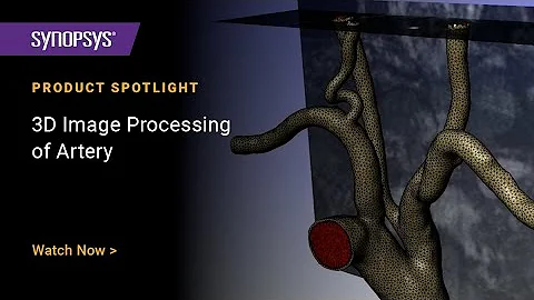 3D Image Processing of Artery in Simpleware