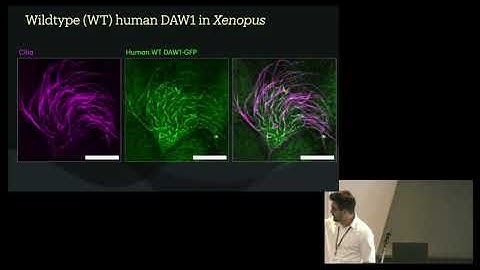 Functional Genomics of Heterotaxy and PCD