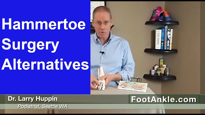 Watch This Video Before Having Hammertoes Surgery – Seattle Podiatrist Larry Huppin