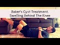 Bakers Cyst Treatment Video