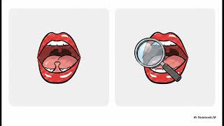 Tongue Tie Speech Therapy Dubai | JBR/Dubai Marina/Palm Jumeirah | Speech Therapy at Next Level Kids