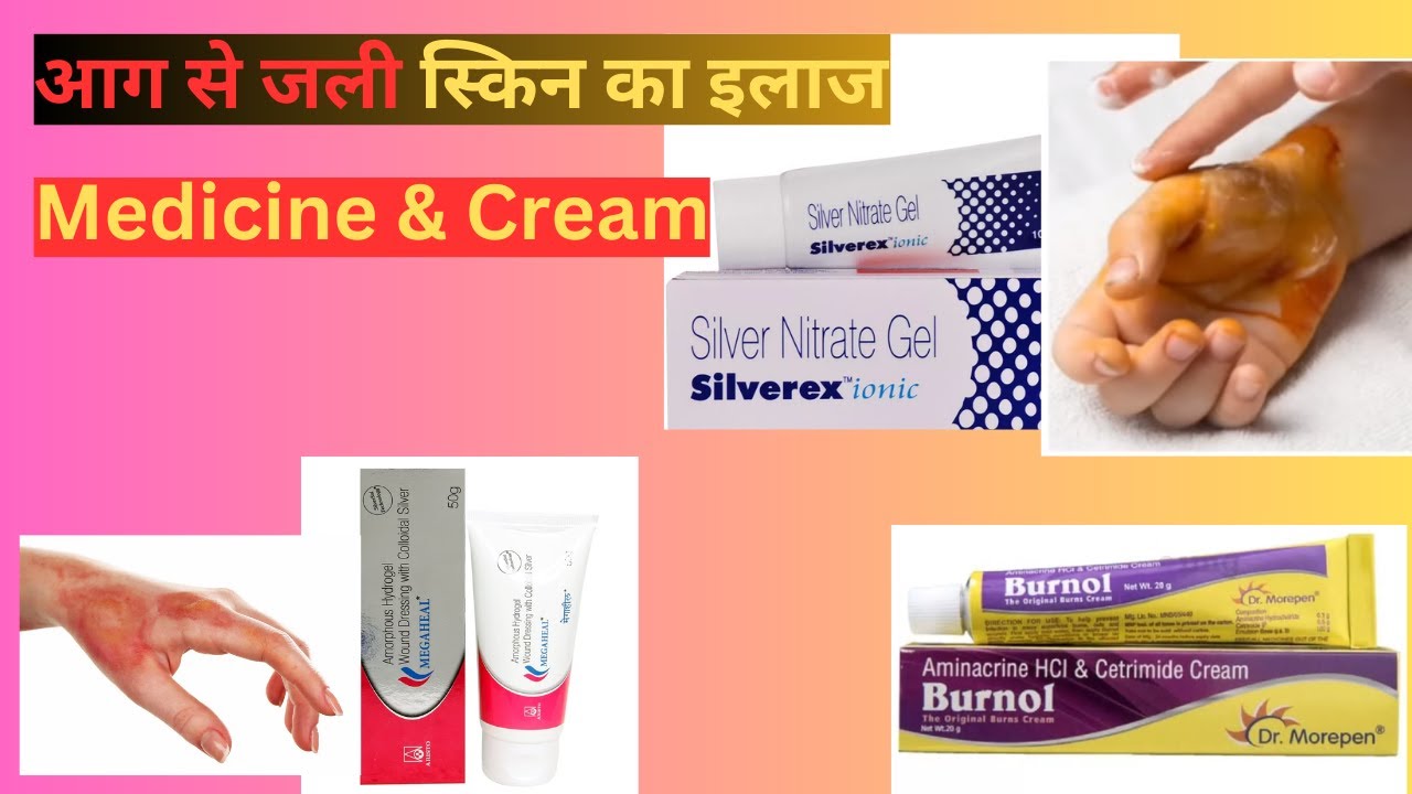 जली हुई स्किन की दवाईयां Burn Skin Treatment Creams for Skin