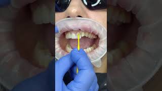 Dental Clinic Limassol offering sophisticated, painless and comprehensive dental services.