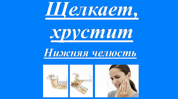 Хрустит и щёлкает нижняя челюсть. #Остеоартроз