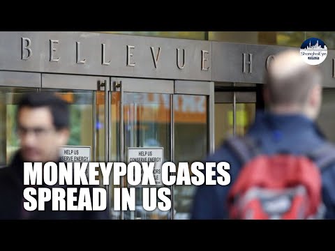US report new Monkeypox cases as WHO says the outbreak can be contained