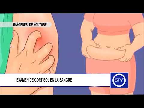 Video: ¿Tienes que ayunar para un análisis de sangre de acth?