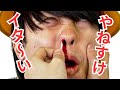 ドパガキやねすけがめちゃくちゃ痛かった！？