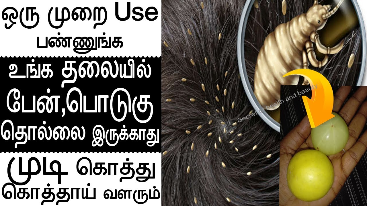 உங்க தலையில் பேன்,பொடுகு தொல்லை இருக்காது pen podugu poga tips in