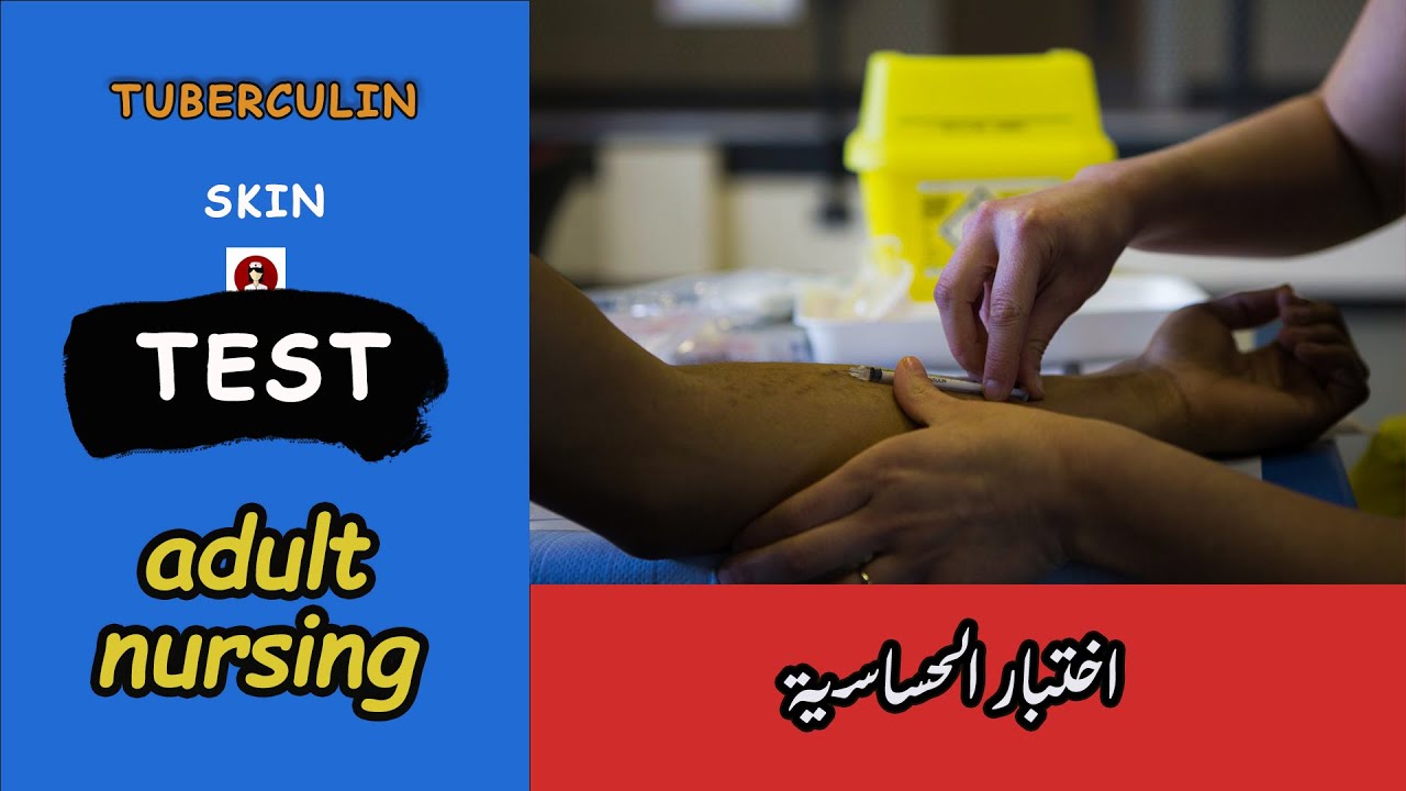اساسيات التمريض ازاى تعمل اختبار الحساسية بأسهل واسرع طريقة |tuberculin skin test