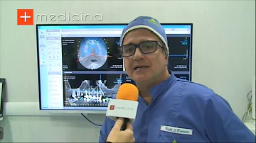 Quanto dura un implantologia dentale?