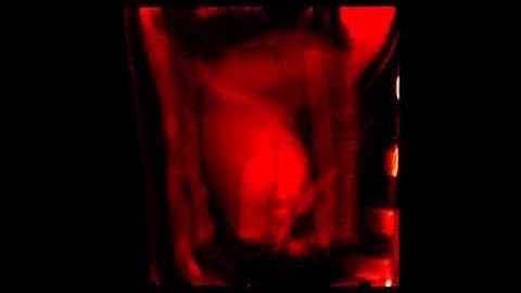 AtomicusChart®: Intensity Projections