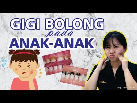 Video: Cara Mengobati Gigi Berlubang Pada Anak Kecil