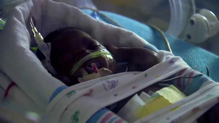 Preemies Fare Well in SWFL